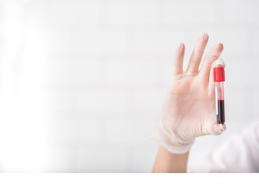 tests sanguins pour les helminthes