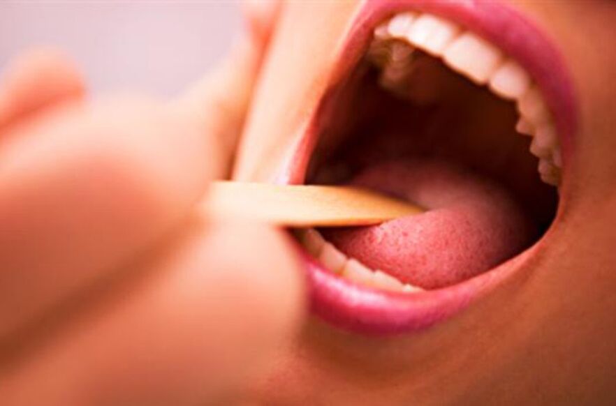 types de parasites dans la bouche humaine